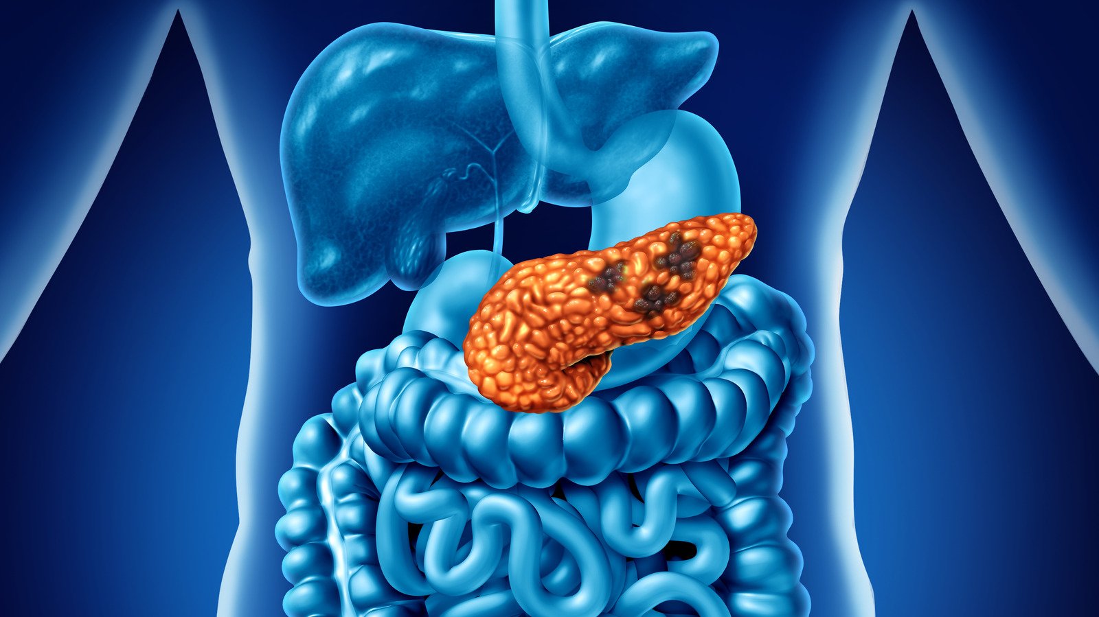 Researchers Study the ALK7 Receptor’s Role in Pancreatic Cancer Progression