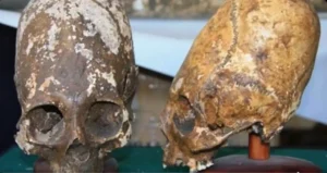 First DNA Results from the Paracas Elongated Skull