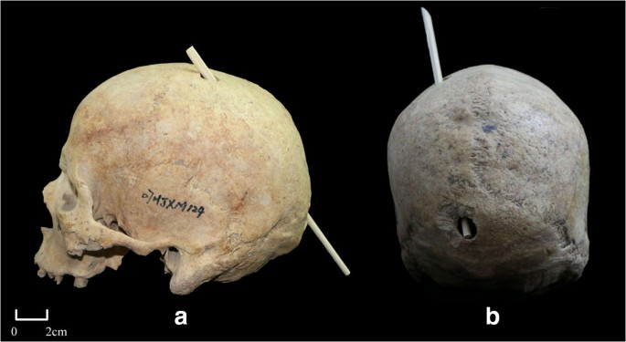 Archaeologists Uncover Evidence of Violence Against Families in an Iron Age Burial 2 Evidence of Violence