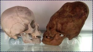 Paracas Elongated Skulls