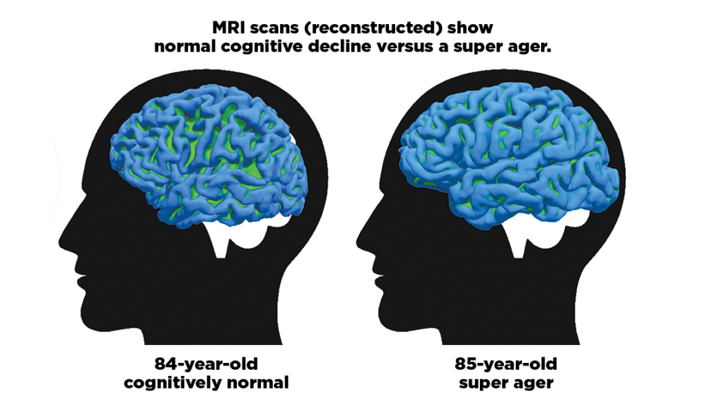 Normal Vs. Superagers Brain Functionality 